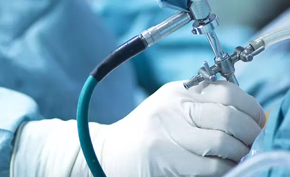 How Shoulder Surgery Can Significantly Enhance Mobility and Function
